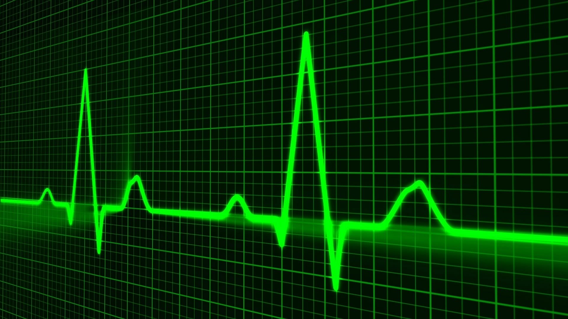 ECG and electrocardiograph