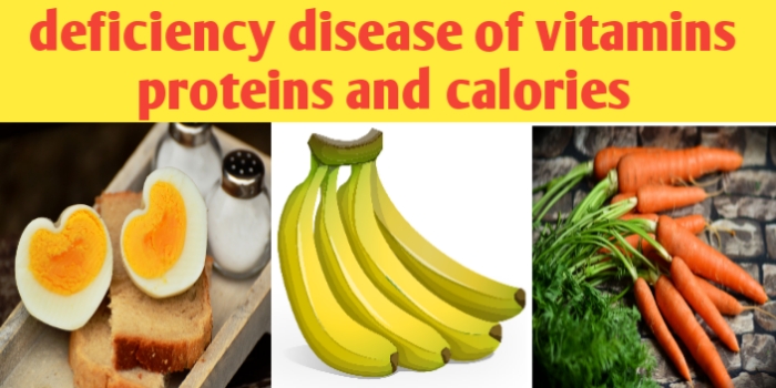 Deficiency diseases of vitamins, proteins and calories