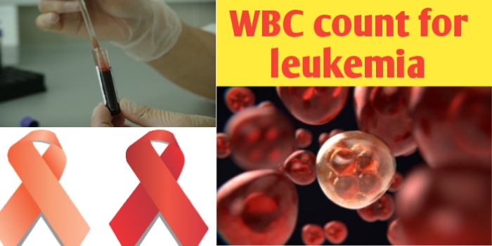 WBC count for leukemia patients, leukemia types and symptoms