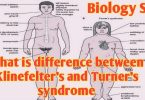 Differences between Klinefelter's and Turner syndrome