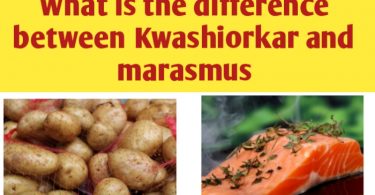 What is the difference between kwashiokar and marasmus