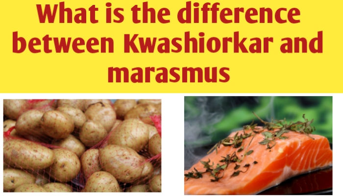 What is the difference between kwashiokar and marasmus