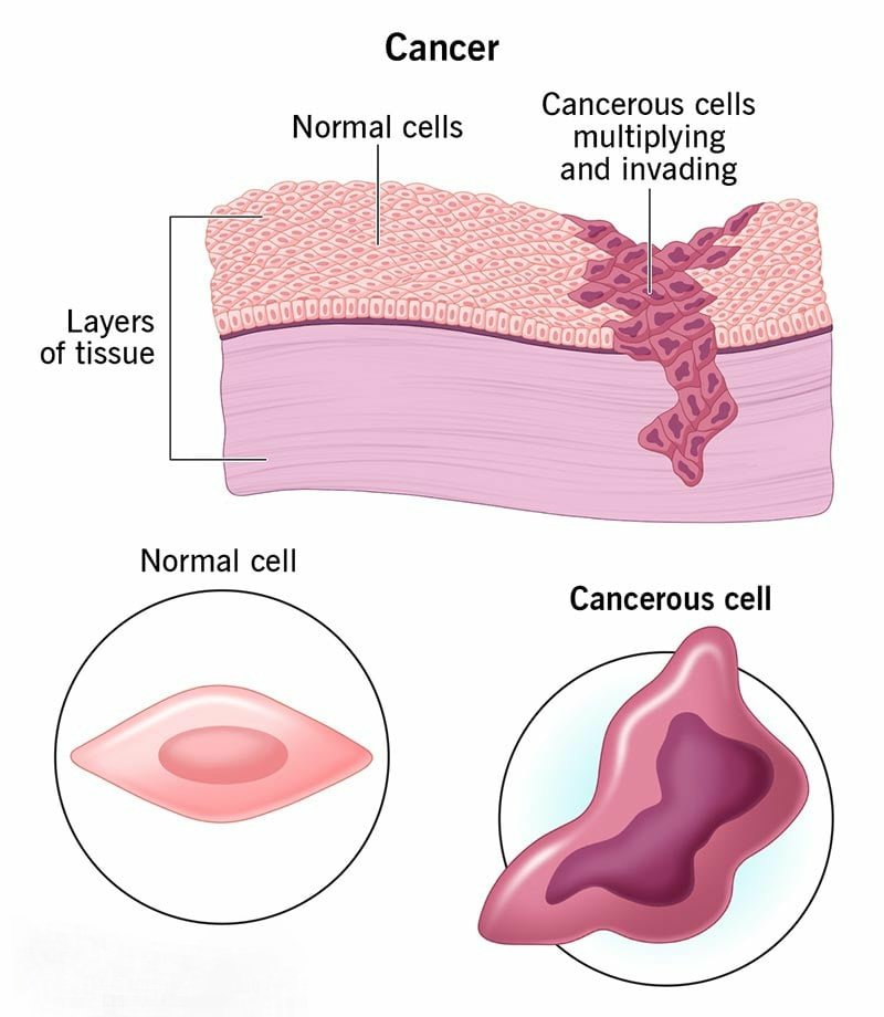 MCQ ON CANCER class 12 for NEET - Biologysir